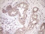 PARG Antibody in Immunohistochemistry (Paraffin) (IHC (P))