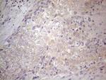 Gemin 2 Antibody in Immunohistochemistry (Paraffin) (IHC (P))