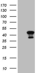 CIAPIN1 Antibody in Western Blot (WB)