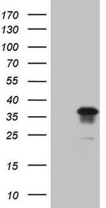 Gemin 2 Antibody in Western Blot (WB)