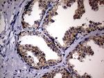 MAK Antibody in Immunohistochemistry (Paraffin) (IHC (P))