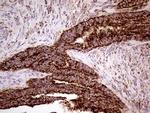 SHMT2 Antibody in Immunohistochemistry (Paraffin) (IHC (P))