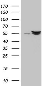 SHMT2 Antibody in Western Blot (WB)