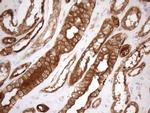 SHMT2 Antibody in Immunohistochemistry (Paraffin) (IHC (P))