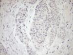 MYOZ1 Antibody in Immunohistochemistry (Paraffin) (IHC (P))