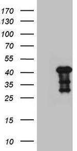 MYOZ1 Antibody in Western Blot (WB)