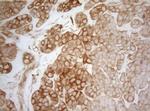 AHA1 Antibody in Immunohistochemistry (Paraffin) (IHC (P))