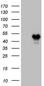 HOXC10 Antibody in Western Blot (WB)