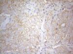 PTK9 Antibody in Immunohistochemistry (Paraffin) (IHC (P))