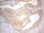 PTK9 Antibody in Immunohistochemistry (Paraffin) (IHC (P))