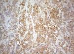 PTK9 Antibody in Immunohistochemistry (Paraffin) (IHC (P))