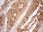 PTK9 Antibody in Immunohistochemistry (Paraffin) (IHC (P))