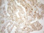 PTK9 Antibody in Immunohistochemistry (Paraffin) (IHC (P))