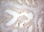 PTK9 Antibody in Immunohistochemistry (Paraffin) (IHC (P))