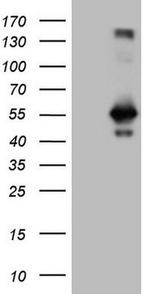 RAB3IP Antibody in Western Blot (WB)