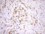 NCF4 Antibody in Immunohistochemistry (Paraffin) (IHC (P))