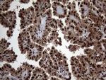 SSU72 Antibody in Immunohistochemistry (Paraffin) (IHC (P))