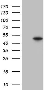 GNAS Antibody in Western Blot (WB)