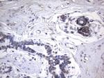 HNRNPA0 Antibody in Immunohistochemistry (Paraffin) (IHC (P))