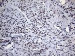 HNRNPA0 Antibody in Immunohistochemistry (Paraffin) (IHC (P))