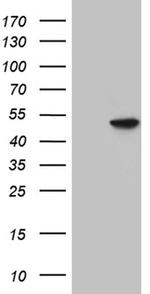 GNAS Antibody in Western Blot (WB)