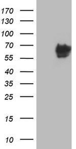 CACNB1 Antibody in Western Blot (WB)