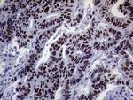 XPB Antibody in Immunohistochemistry (Paraffin) (IHC (P))