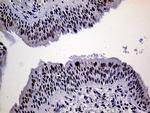 XPB Antibody in Immunohistochemistry (Paraffin) (IHC (P))