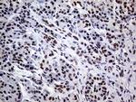 XPB Antibody in Immunohistochemistry (Paraffin) (IHC (P))