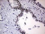 XPB Antibody in Immunohistochemistry (Paraffin) (IHC (P))