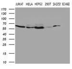 FTO Antibody in Western Blot (WB)