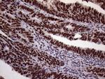 XRN2 Antibody in Immunohistochemistry (Paraffin) (IHC (P))