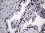 POLR3H Antibody in Immunohistochemistry (Paraffin) (IHC (P))