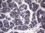 SF1 Antibody in Immunohistochemistry (Paraffin) (IHC (P))