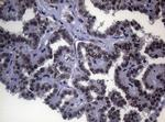 SF1 Antibody in Immunohistochemistry (Paraffin) (IHC (P))