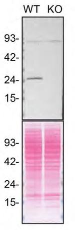 RAB3A Antibody in Western Blot (WB)