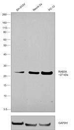 RAB3A Antibody in Western Blot (WB)