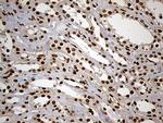 MEIS1 Antibody in Immunohistochemistry (Paraffin) (IHC (P))