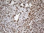 MEIS1 Antibody in Immunohistochemistry (Paraffin) (IHC (P))