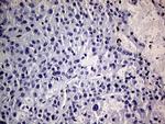 MEIS1 Antibody in Immunohistochemistry (Paraffin) (IHC (P))