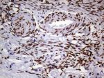 MEIS1 Antibody in Immunohistochemistry (Paraffin) (IHC (P))