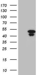 HOXD9 Antibody in Western Blot (WB)