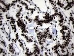 HOXC4 Antibody in Immunohistochemistry (Paraffin) (IHC (P))