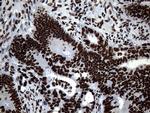 SH3BGRL Antibody in Immunohistochemistry (Paraffin) (IHC (P))