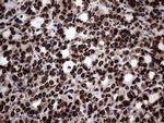 SH3BGRL Antibody in Immunohistochemistry (Paraffin) (IHC (P))