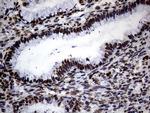 SH3BGRL Antibody in Immunohistochemistry (Paraffin) (IHC (P))