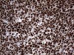 SH3BGRL Antibody in Immunohistochemistry (Paraffin) (IHC (P))