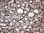 SH3BGRL Antibody in Immunohistochemistry (Paraffin) (IHC (P))