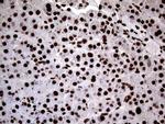 SH3BGRL Antibody in Immunohistochemistry (Paraffin) (IHC (P))