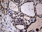 SH3BGRL Antibody in Immunohistochemistry (Paraffin) (IHC (P))